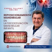 Laterodesviación mandibular